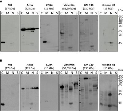 Myoglobin Protects Breast Cancer Cells Due to Its ROS and NO Scavenging Properties